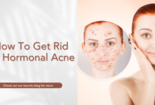 How To Get Rid Of Hormonal Acne And Achieve Clear Skin